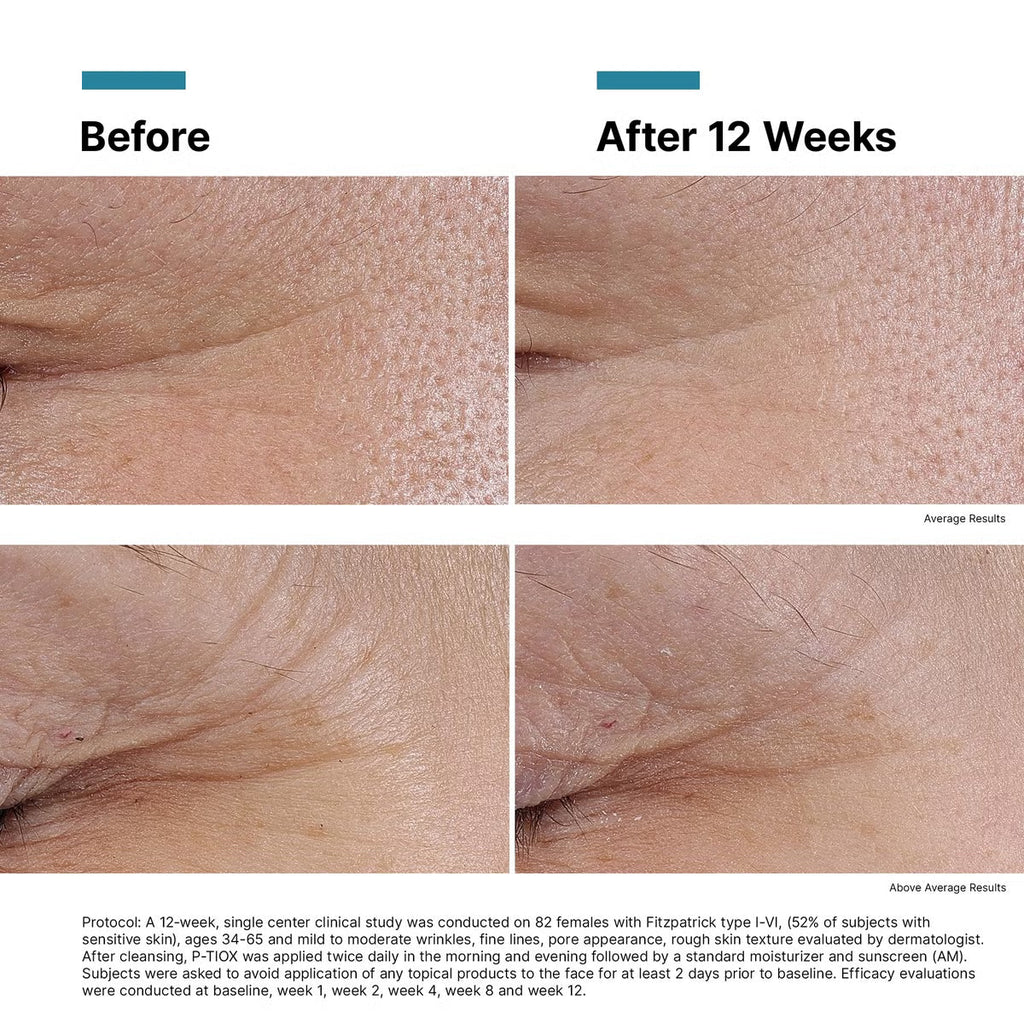 SkinCeuticals P-TIOX Anti-Wrinkle Peptide Serum (1 fl. oz.)