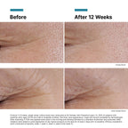 SkinCeuticals P-TIOX Anti-Wrinkle Peptide Serum (1 fl. oz.)