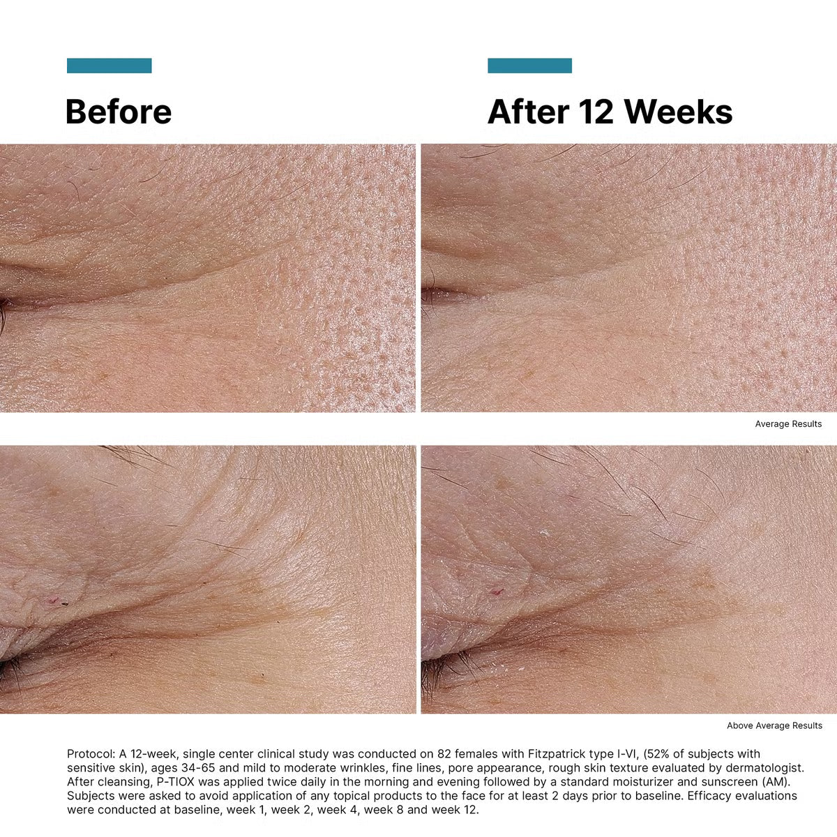 SkinCeuticals P-TIOX Anti-Wrinkle Peptide Serum (1 fl. oz.)