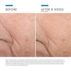 SkinCeuticals Triple Lipid Restore 2:4:2 (1.6 fl. oz.)SkinCeuticals Triple Lipid Restore 2:4:2 (1.6 fl. oz.)