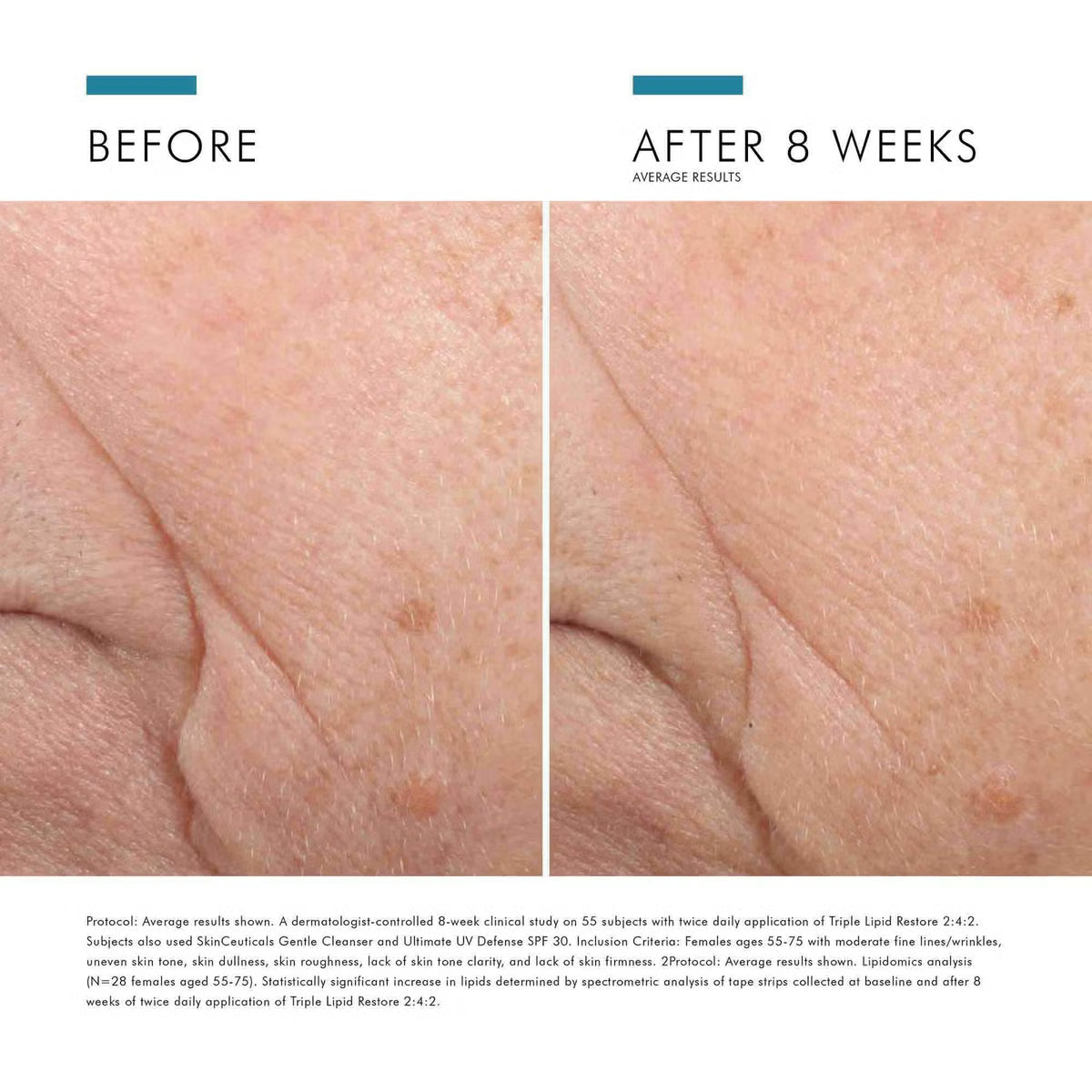 SkinCeuticals Triple Lipid Restore 2:4:2 (1.6 fl. oz.)SkinCeuticals Triple Lipid Restore 2:4:2 (1.6 fl. oz.)