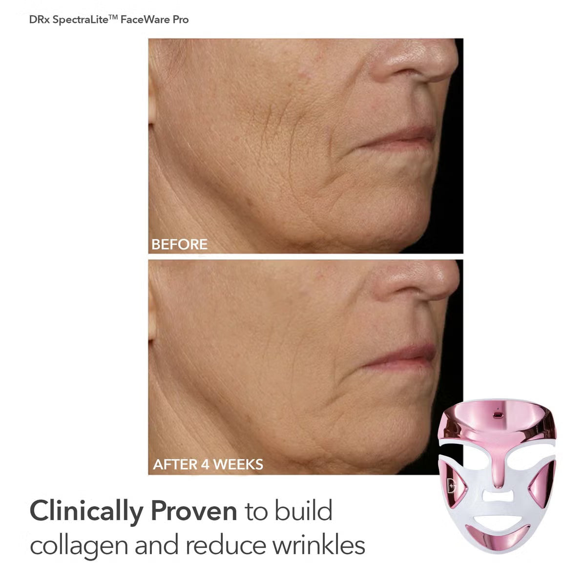 Dr Dennis Gross SpectraLite™ FaceWare Pro (1 piece)